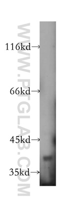 PNMA2 Antibody in Western Blot (WB)