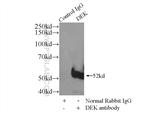 DEK Antibody in Immunoprecipitation (IP)