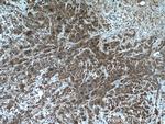 AGXT2L2 Antibody in Immunohistochemistry (Paraffin) (IHC (P))