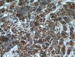 AGXT2L2 Antibody in Immunohistochemistry (Paraffin) (IHC (P))