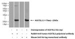 AGXT2L2 Antibody in Western Blot (WB)