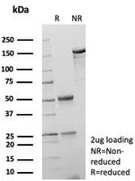 Aldo-keto Reductase Family 1 Member C1/DD1 Antibody in SDS-PAGE (SDS-PAGE)