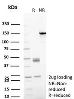 Aldo-keto Reductase Family 1 Member C1/DD1 Antibody in SDS-PAGE (SDS-PAGE)