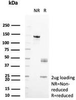 Aldo-keto Reductase Family 1 Member C1/DD1 Antibody in SDS-PAGE (SDS-PAGE)