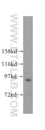 MCM8 Antibody in Western Blot (WB)