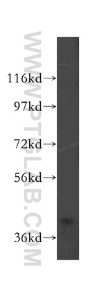 DNAJB5 Antibody in Western Blot (WB)
