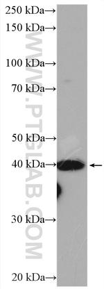 DNAJB5 Antibody in Western Blot (WB)