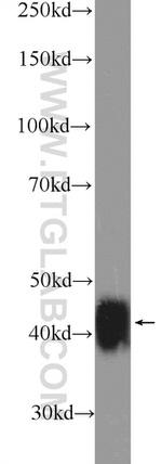 XPA Antibody in Western Blot (WB)