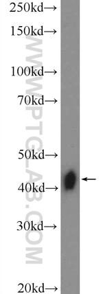 XPA Antibody in Western Blot (WB)