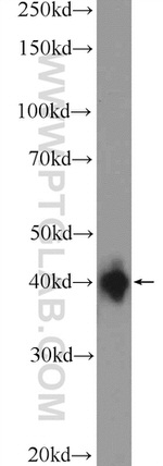 XPA Antibody in Western Blot (WB)
