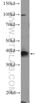 XPA Antibody in Western Blot (WB)