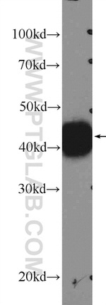 XPA Antibody in Western Blot (WB)