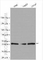 TBC1D20 Antibody in Western Blot (WB)