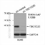 TBC1D20 Antibody in Western Blot (WB)