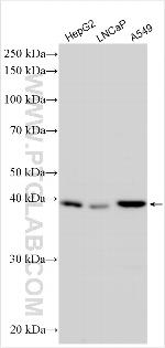 TBC1D20 Antibody in Western Blot (WB)