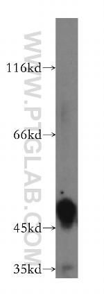 HGD Antibody in Western Blot (WB)