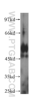 HGD Antibody in Western Blot (WB)