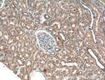 ADH4 Antibody in Immunohistochemistry (Paraffin) (IHC (P))