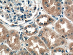 ADH4 Antibody in Immunohistochemistry (Paraffin) (IHC (P))