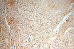 ADH4 Antibody in Immunohistochemistry (Paraffin) (IHC (P))