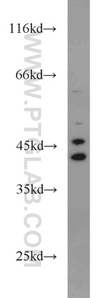 ADH4 Antibody in Western Blot (WB)