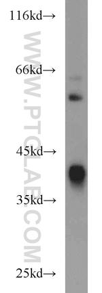 ADH4 Antibody in Western Blot (WB)
