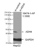 ADH4 Antibody in Western Blot (WB)