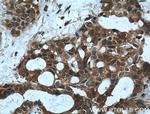 MVP/LRP Antibody in Immunohistochemistry (Paraffin) (IHC (P))