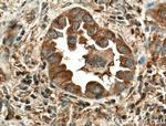 MVP/LRP Antibody in Immunohistochemistry (Paraffin) (IHC (P))