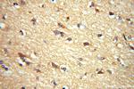 ADO Antibody in Immunohistochemistry (Paraffin) (IHC (P))
