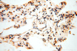 NDUFA4L2 Antibody in Immunohistochemistry (Paraffin) (IHC (P))