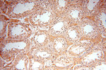 NDUFA4L2 Antibody in Immunohistochemistry (Paraffin) (IHC (P))