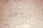 NDUFA4L2 Antibody in Immunohistochemistry (Paraffin) (IHC (P))