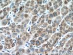 NDUFA4L2 Antibody in Immunohistochemistry (Paraffin) (IHC (P))