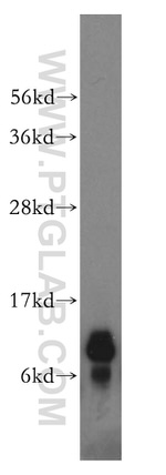NDUFA4L2 Antibody in Western Blot (WB)
