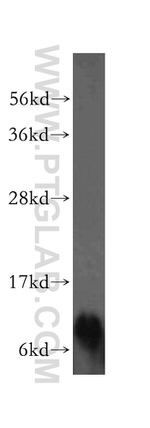 NDUFA4L2 Antibody in Western Blot (WB)