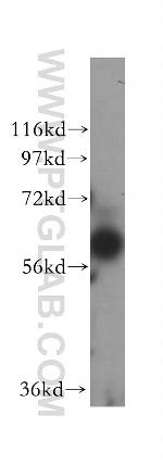 BTN2A2 Antibody in Western Blot (WB)