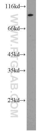 RBM28 Antibody in Western Blot (WB)