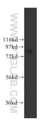 RBM28 Antibody in Western Blot (WB)