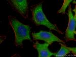 EDC3 Antibody in Immunocytochemistry (ICC/IF)