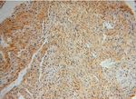 EDC3 Antibody in Immunohistochemistry (Paraffin) (IHC (P))