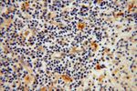 EDC3 Antibody in Immunohistochemistry (Paraffin) (IHC (P))
