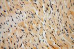 EDC3 Antibody in Immunohistochemistry (Paraffin) (IHC (P))