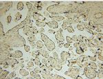 EDC3 Antibody in Immunohistochemistry (Paraffin) (IHC (P))