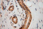 EDC3 Antibody in Immunohistochemistry (Paraffin) (IHC (P))