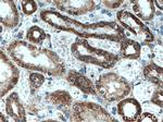 EDC3 Antibody in Immunohistochemistry (Paraffin) (IHC (P))