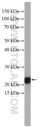 RPL26L1 Antibody in Western Blot (WB)
