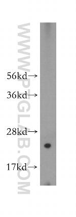 RPL26L1 Antibody in Western Blot (WB)