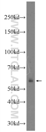 IGHD Antibody in Western Blot (WB)