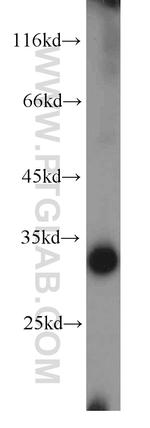 MRPL2 Antibody in Western Blot (WB)